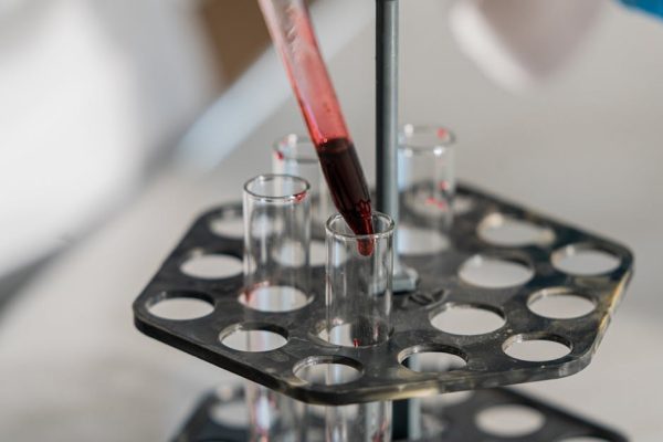 Red liquid being transferred into test tubes in a lab setting for research.
