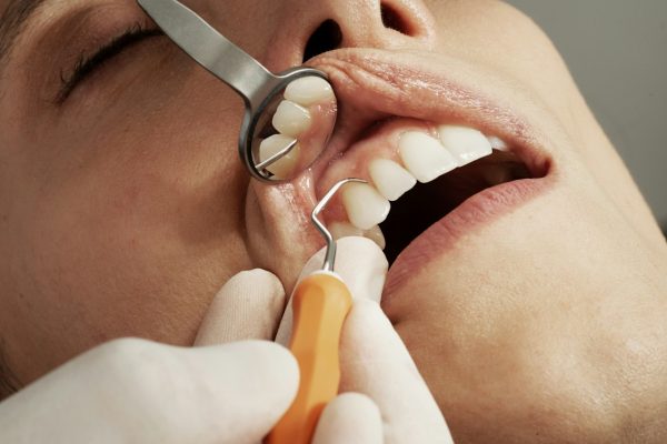 The most expensive dental keywords in Singapore — Dental Google Ads CPC in Singapore: October 2026 Data