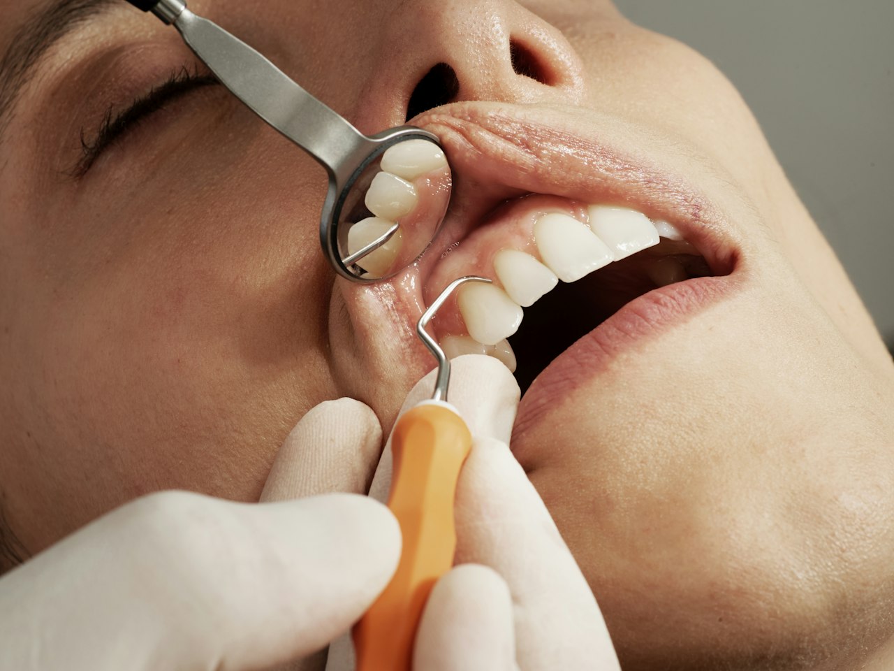 The most expensive dental keywords in Singapore — Dental Google Ads CPC in Singapore: October 2026 Data