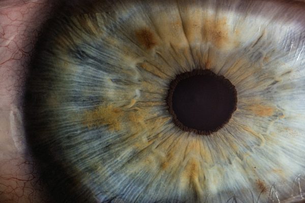 The most expensive eye care keywords in Singapore — Eye Clinic Google Ads CPC in Singapore: October 2026 Data